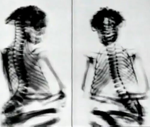 Рентгеновские снимки мумии Педро